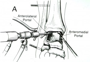 Ankle Scope 2